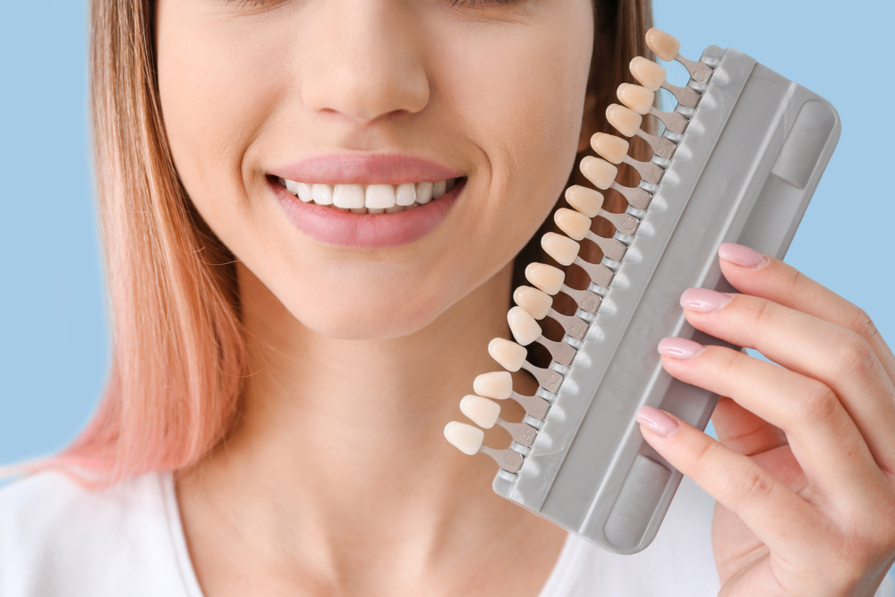 Dental Veneers Holladay